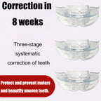 Invisible Braces Orthodontic Braces | Other