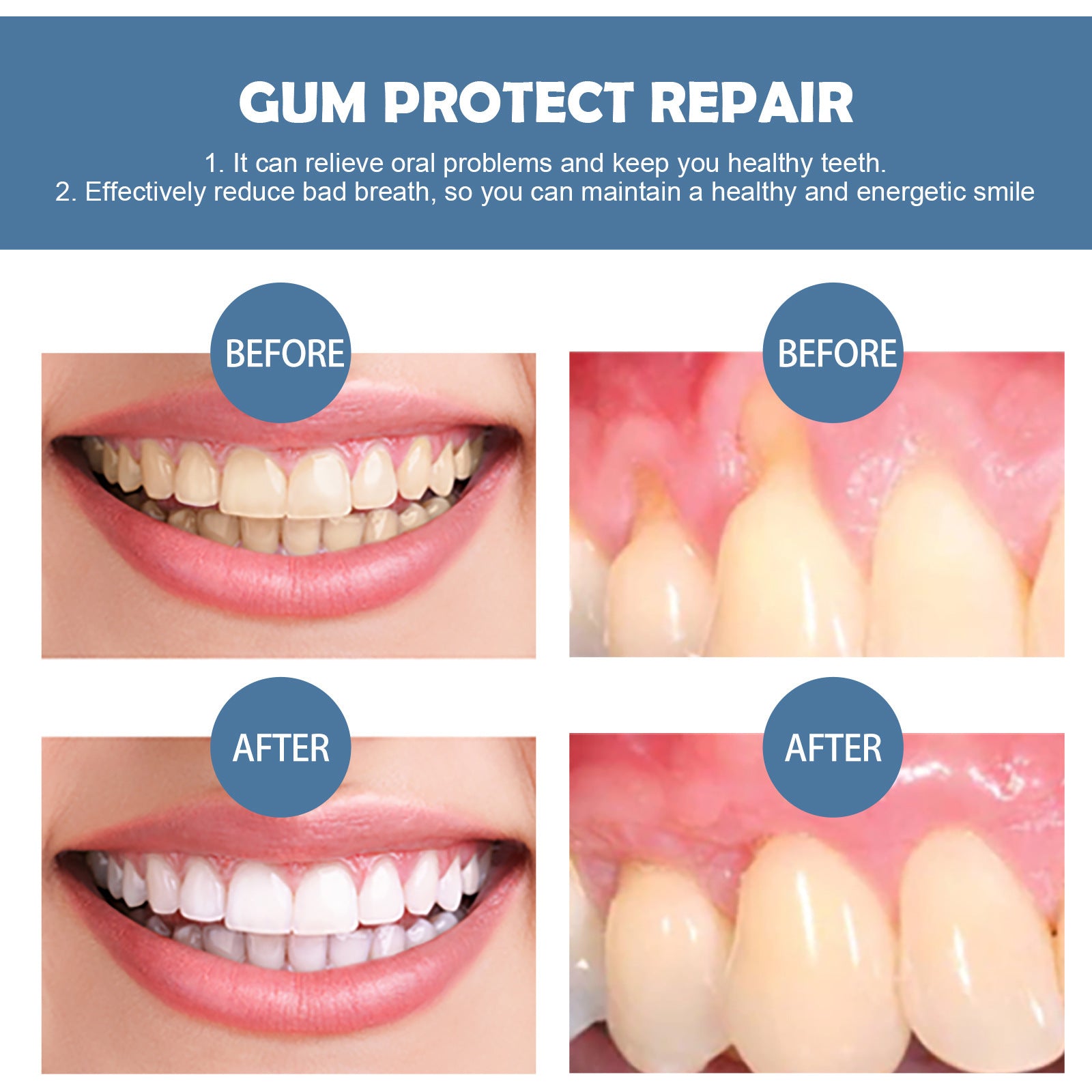 Eelhoe Gum Repair Series Cleaning | Other