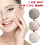 Hoygi Black Spot Repair Essence Lighten Skin Black