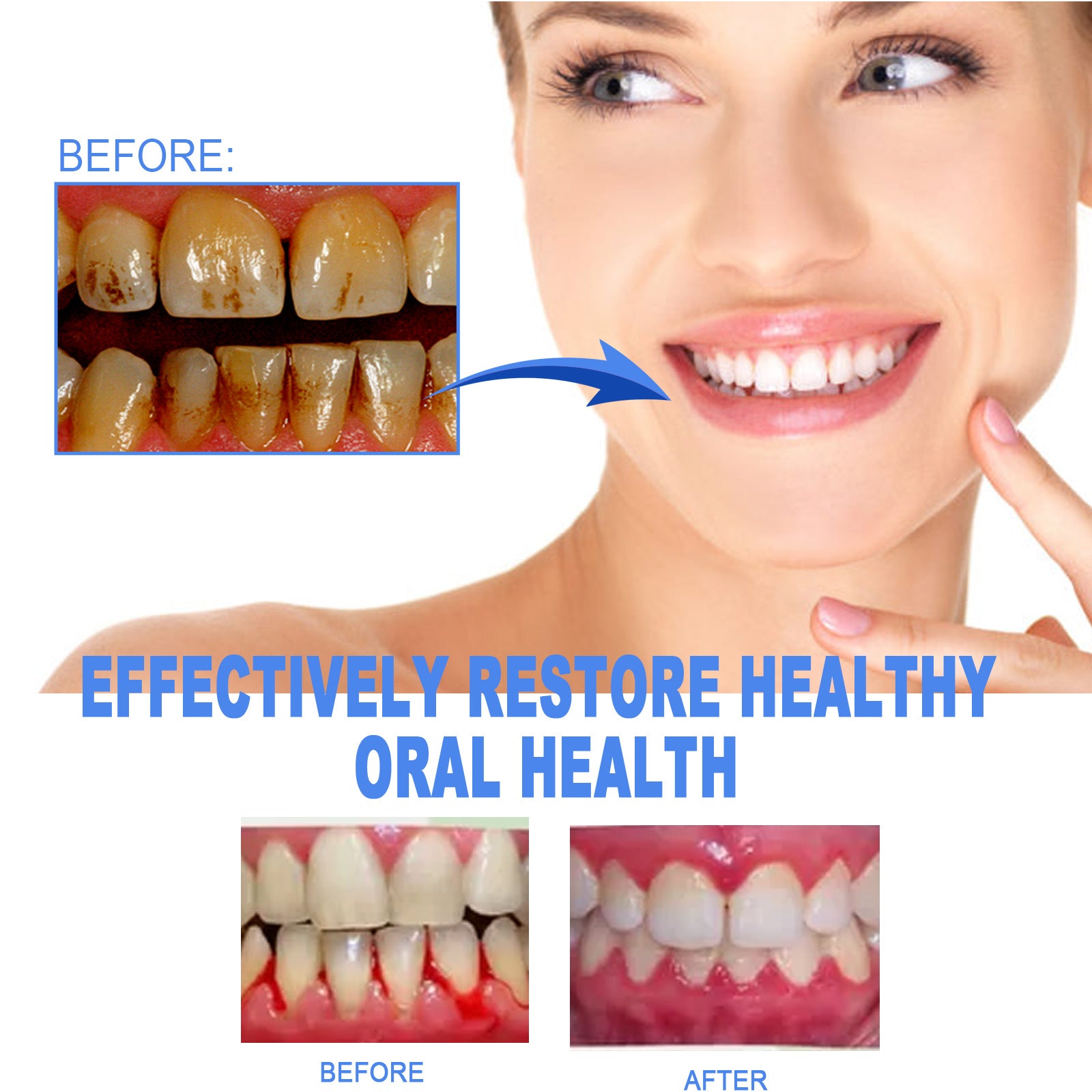 Eelhoe Dental Repair Gel, Repair Gums Cleaning Dental Stains | Other
