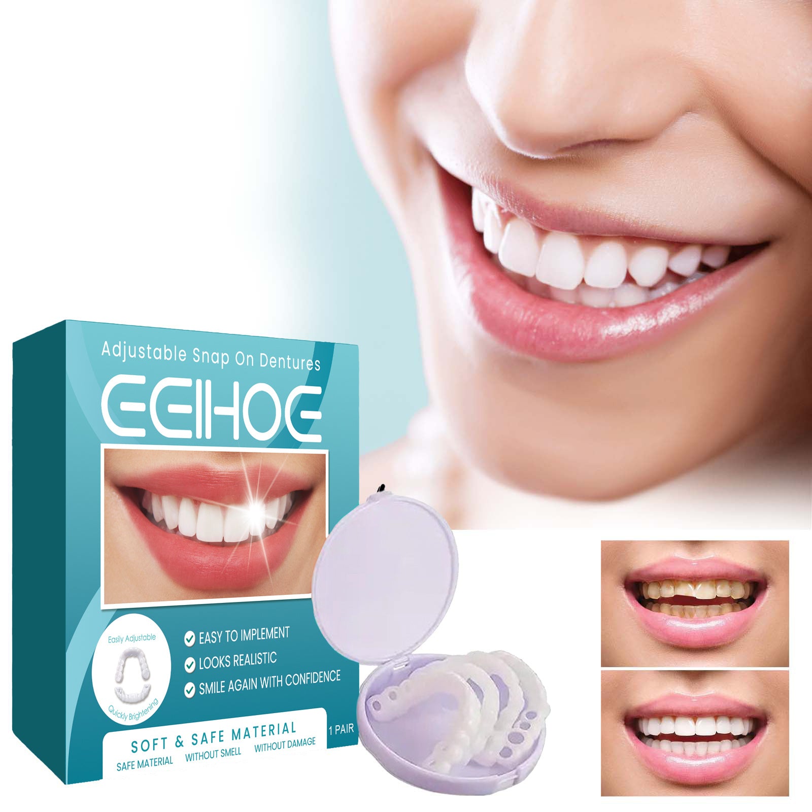 Eelhoe Adjustable Buckle Denture, Temporary Fillings Interde | Other