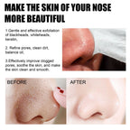 Eelhoe Blackhead Removal Nasal Mask Deep Pore Cleansing Blac | Other