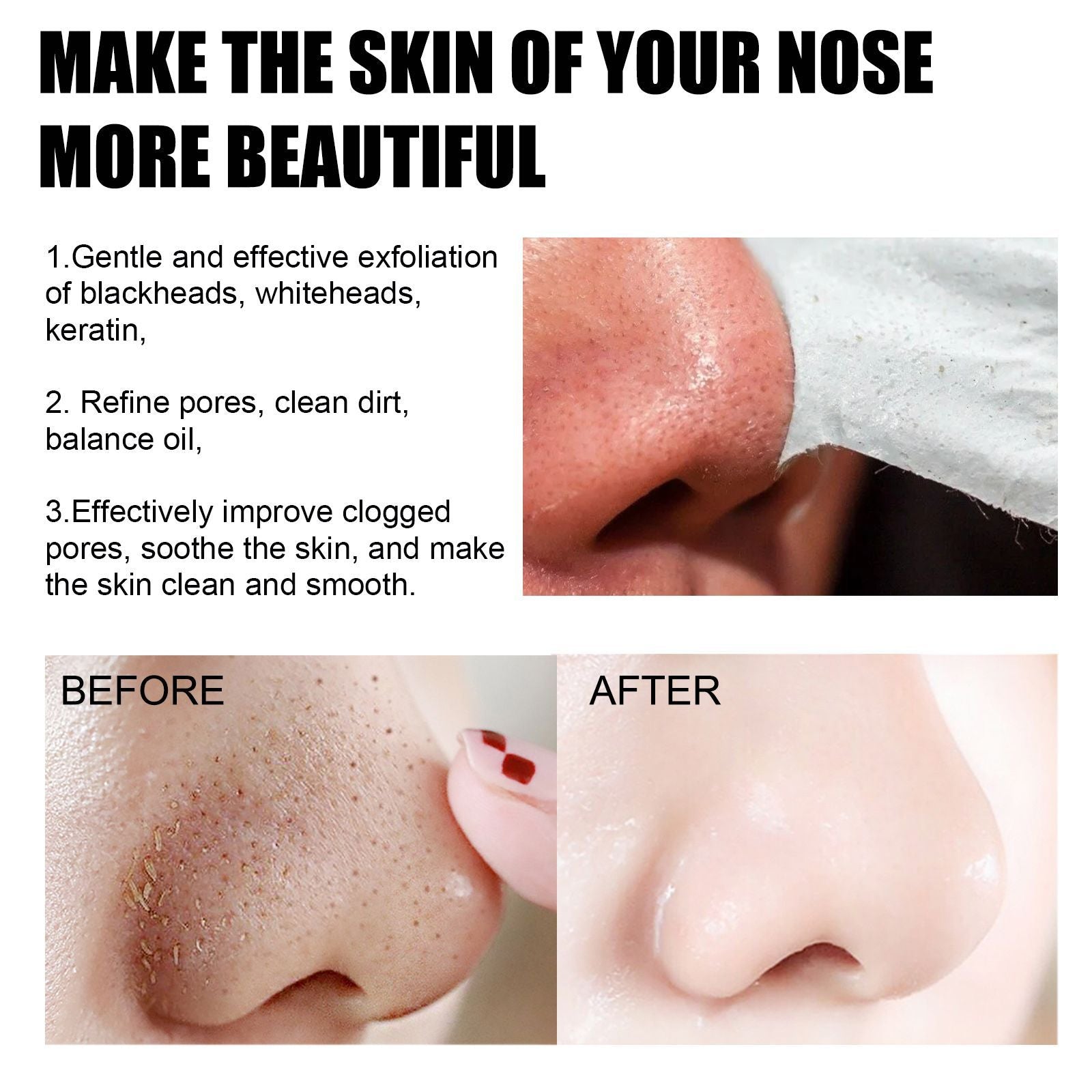 Eelhoe Blackhead Removal Nasal Mask Deep Pore Cleansing Blac | Other