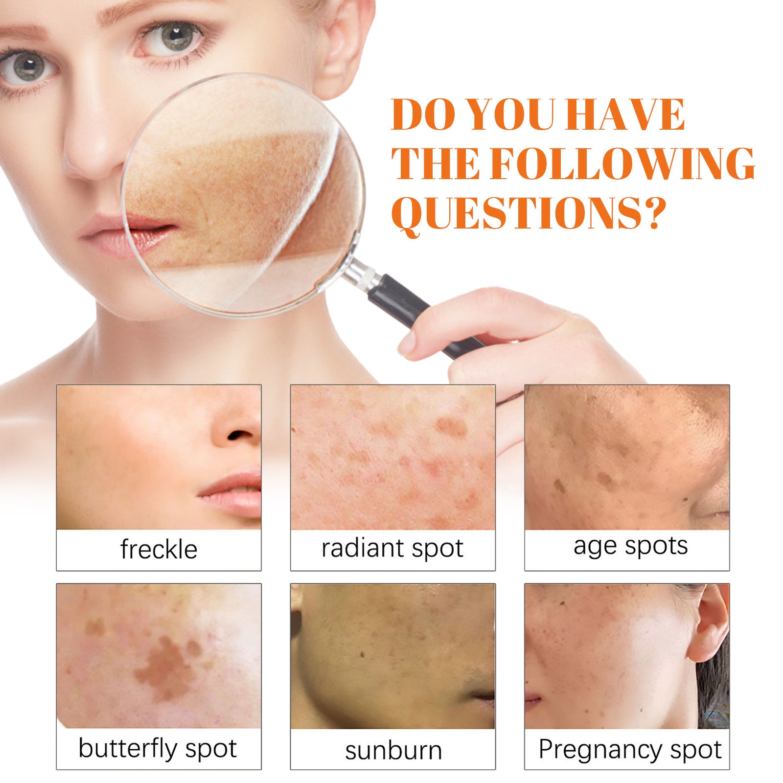 Eelhoe Papaya Whitening Freckle Cream
