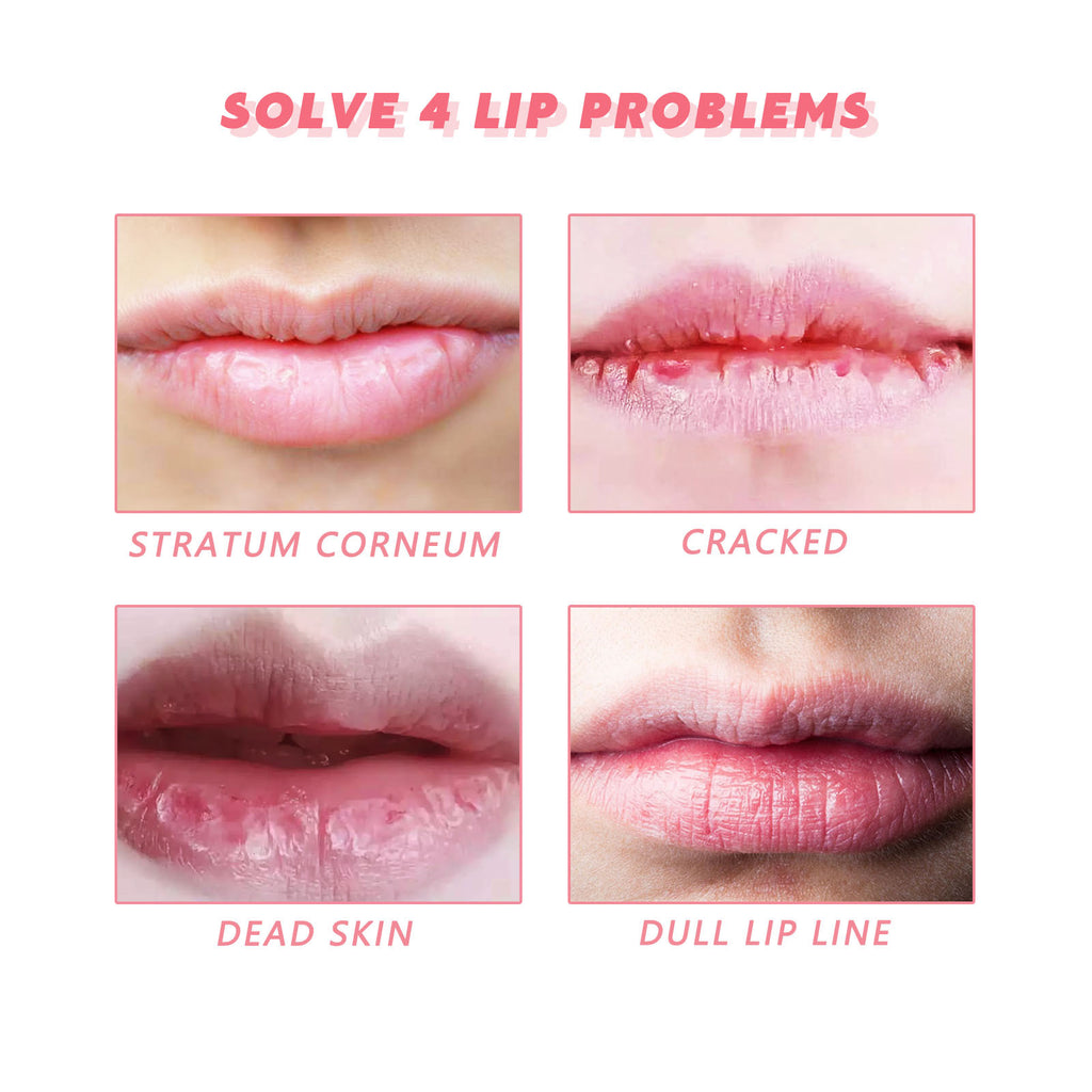 Eelhoe Peach Lip Scrub For Fading Lip Lines, Removing Dead S | Other