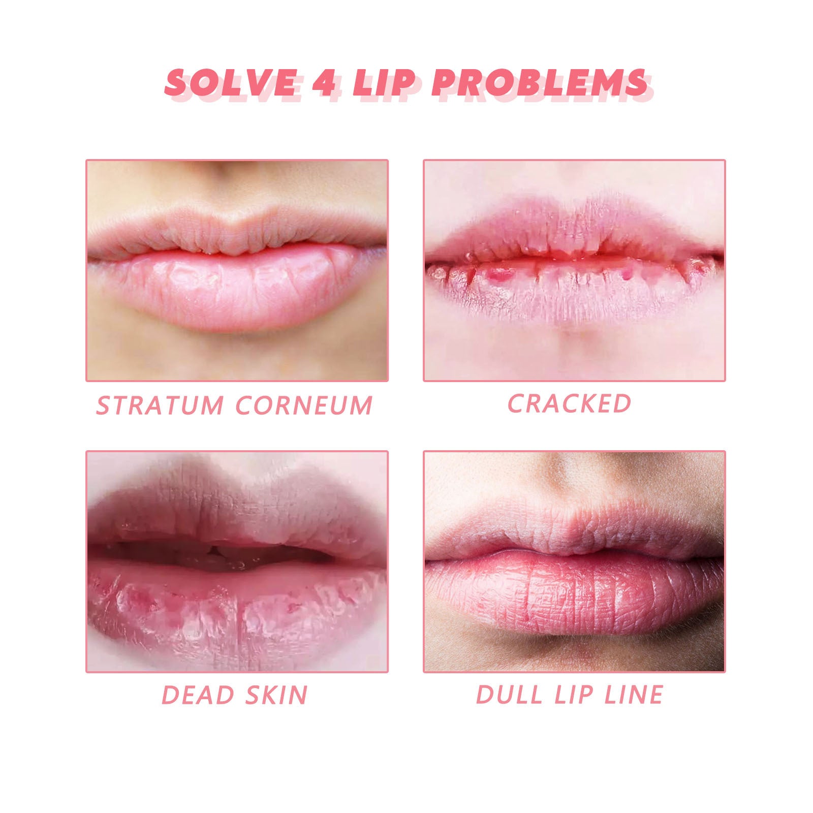 Eelhoe Peach Lip Scrub For Fading Lip Lines, Removing Dead S | Other