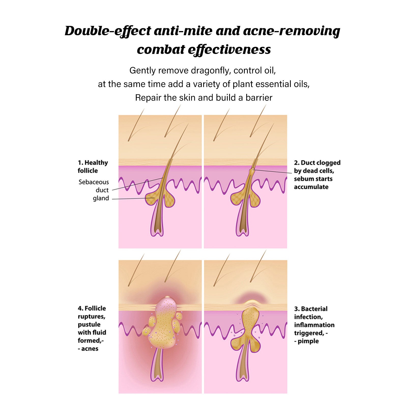 Jaysuing Acne Removing Mite Skin Soap Acne Inhibiting Cleans | Other