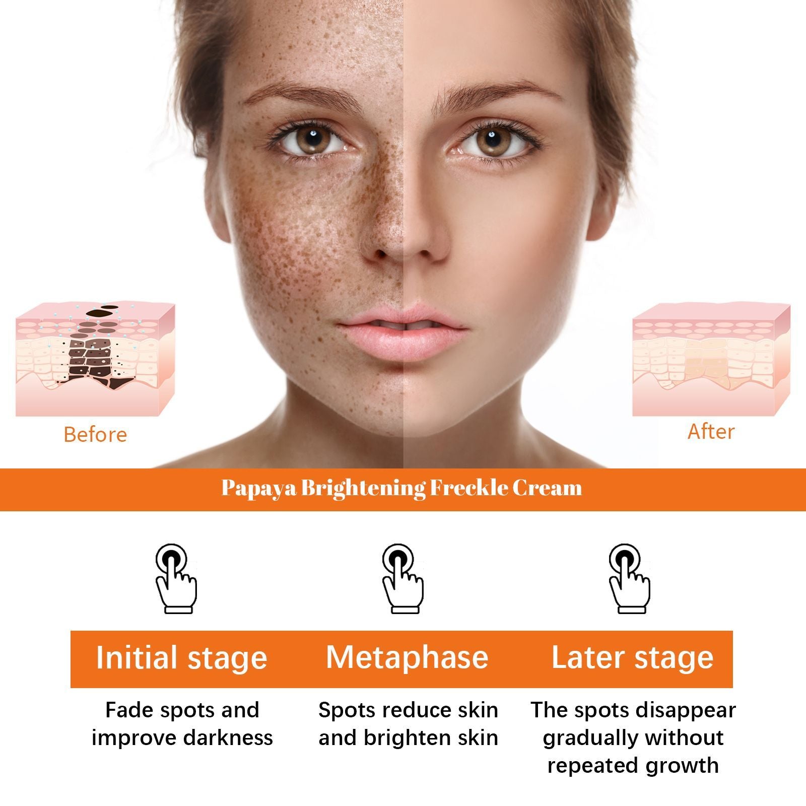 Eelhoe Papaya Whitening Freckle Cream