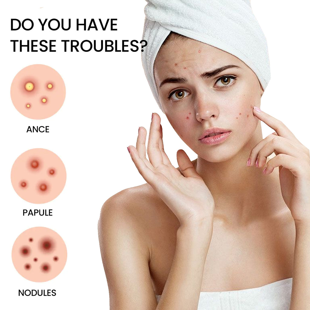 Jaysuing Star Colored Acne Stickers Repair Acne Pits & Marks | Other