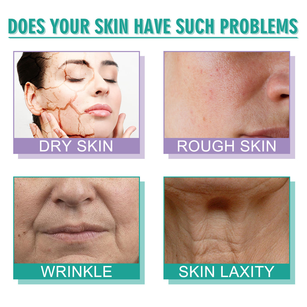 Hoygi Moisturizing Skin Care Cream Lighten Pigmentation Fine | Other