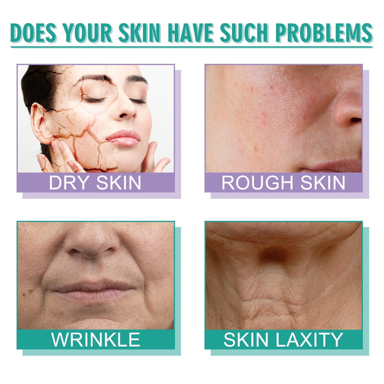 Hoygi Moisturizing Skin Care Cream Lighten Pigmentation Fine | Other