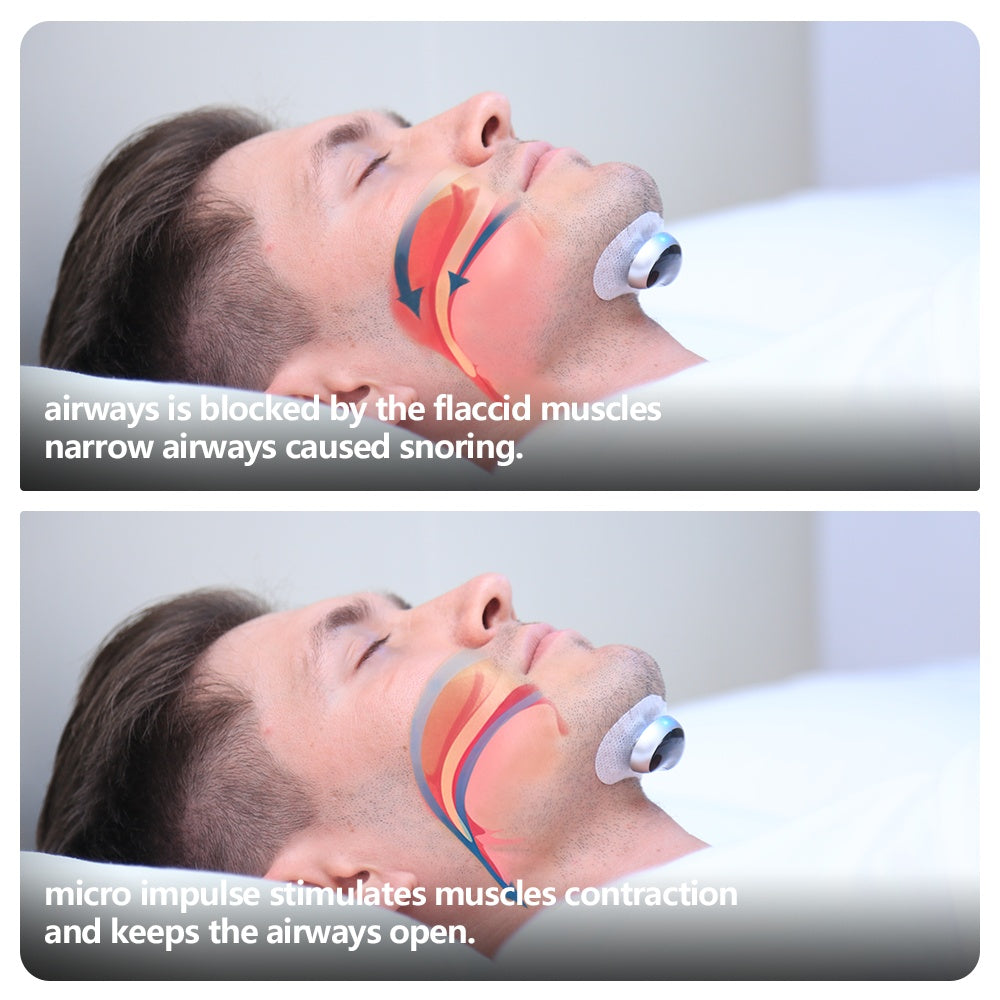Smart Anti Snoring Device Electronic Muscle Stimulator | Jewelry & Accessories