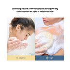 Jaysuing Acne Removing Mite Skin Soap Acne Inhibiting Cleans | Other