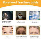 Eelhoe Forehead Wrinkle Patch Lift And Smooth Forehead Wrink | Other