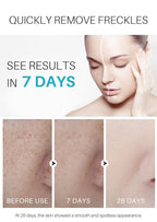 Spot Black Cream Rose Scent Repair Skin | Other