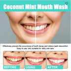 Oralhoe Coconut Mint Mouth Wash, Whitening Teeth Yellow Teet | Other