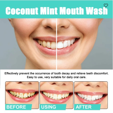 Oralhoe Coconut Mint Mouth Wash, Whitening Teeth Yellow Teet | Other
