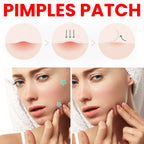 Jaysuing Star Colored Acne Stickers Repair Acne Pits & Marks | Other