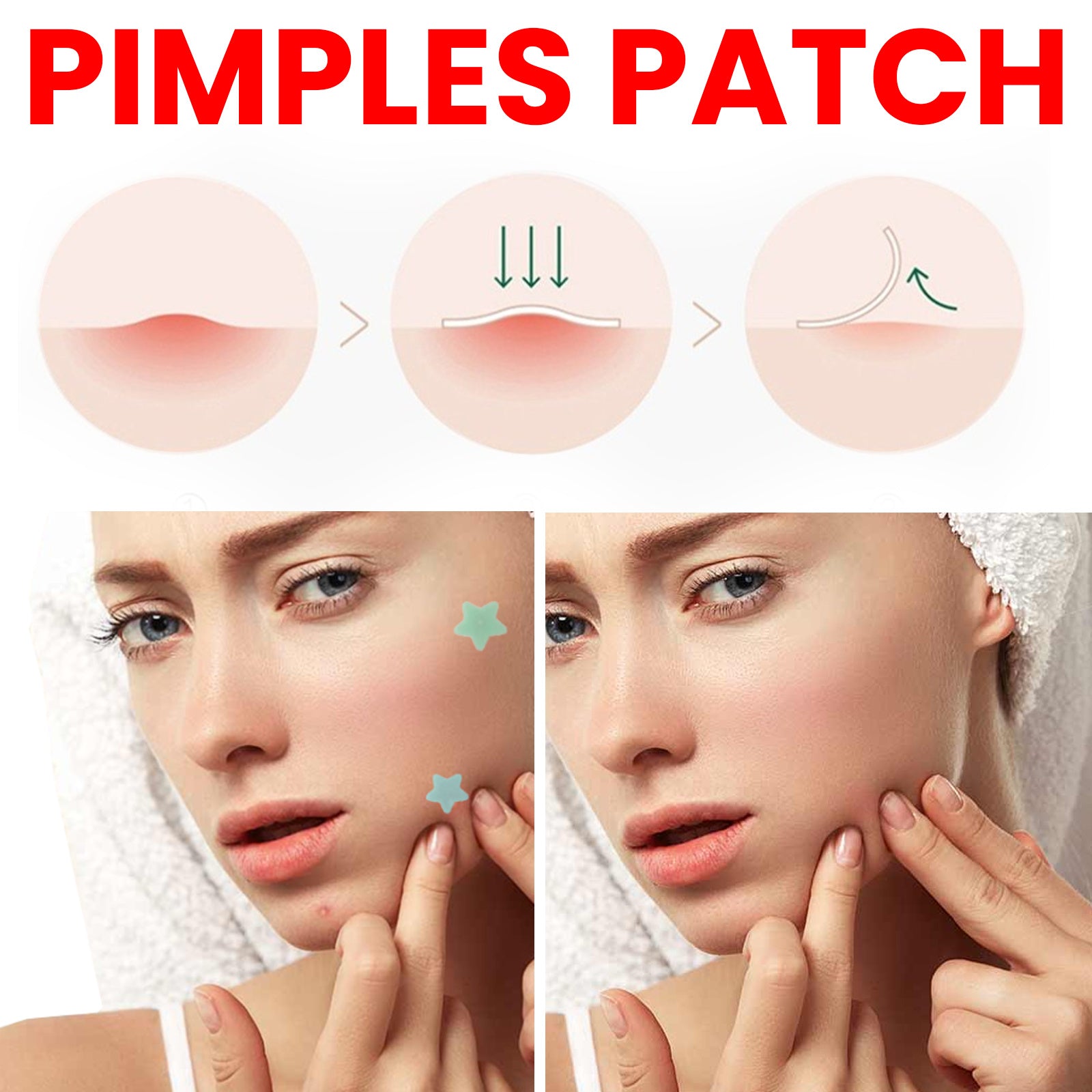 Jaysuing Star Colored Acne Stickers Repair Acne Pits & Marks | Other