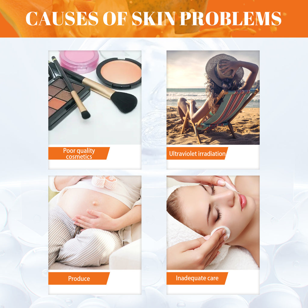 Eelhoe Papaya Whitening Freckle Cream