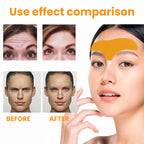 Eelhoe Forehead Wrinkle Patch Lift And Smooth Forehead Wrink | Other