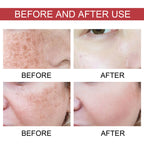 Hoygi Black Spot Repair Essence Lighten Skin Black