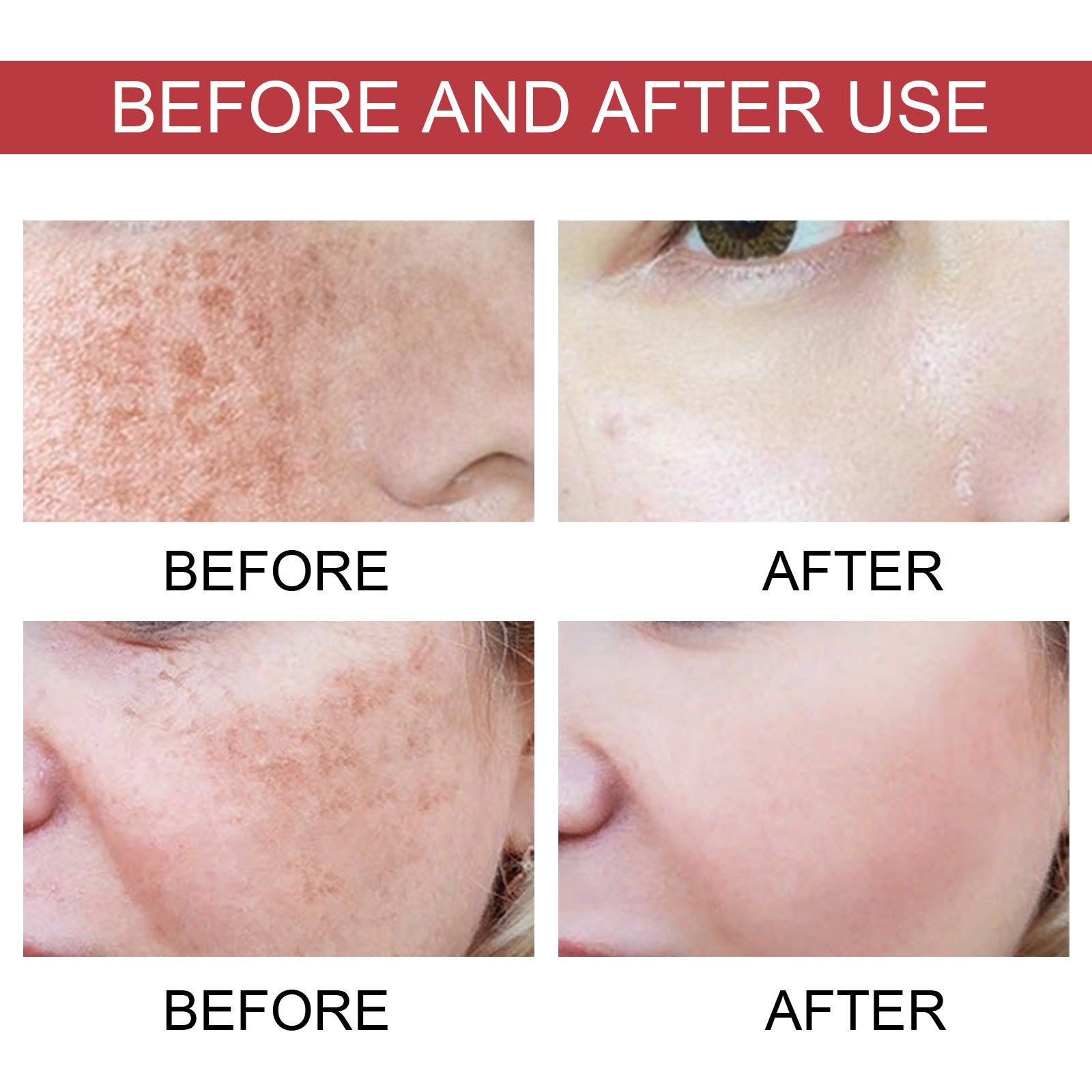 Hoygi Black Spot Repair Essence Lighten Skin Black