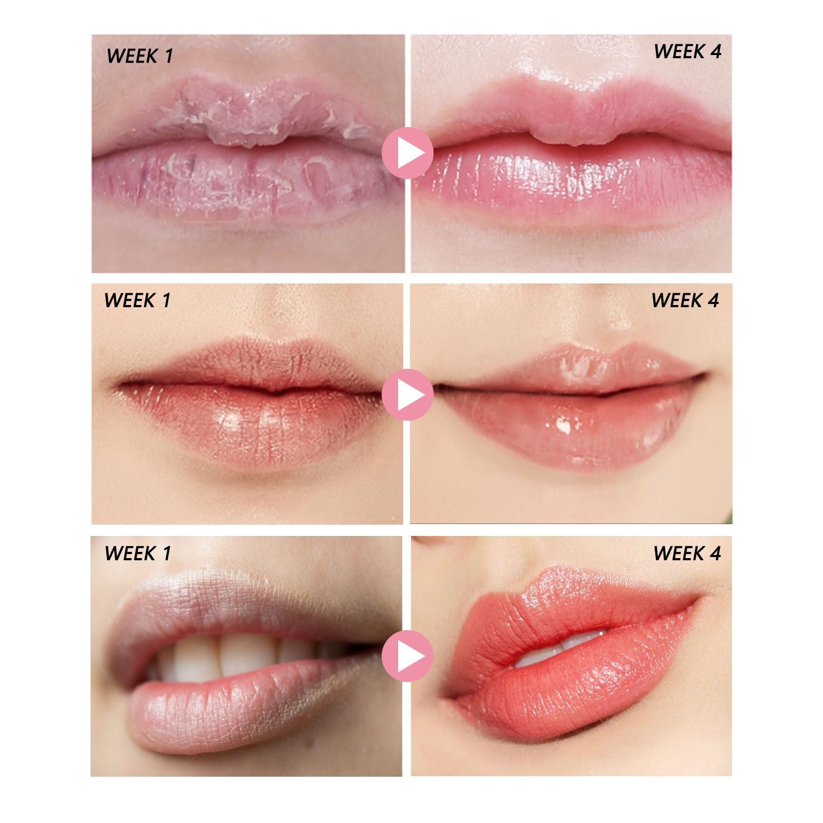 Eelhoe Peach Lip Scrub For Fading Lip Lines, Removing Dead S | Other