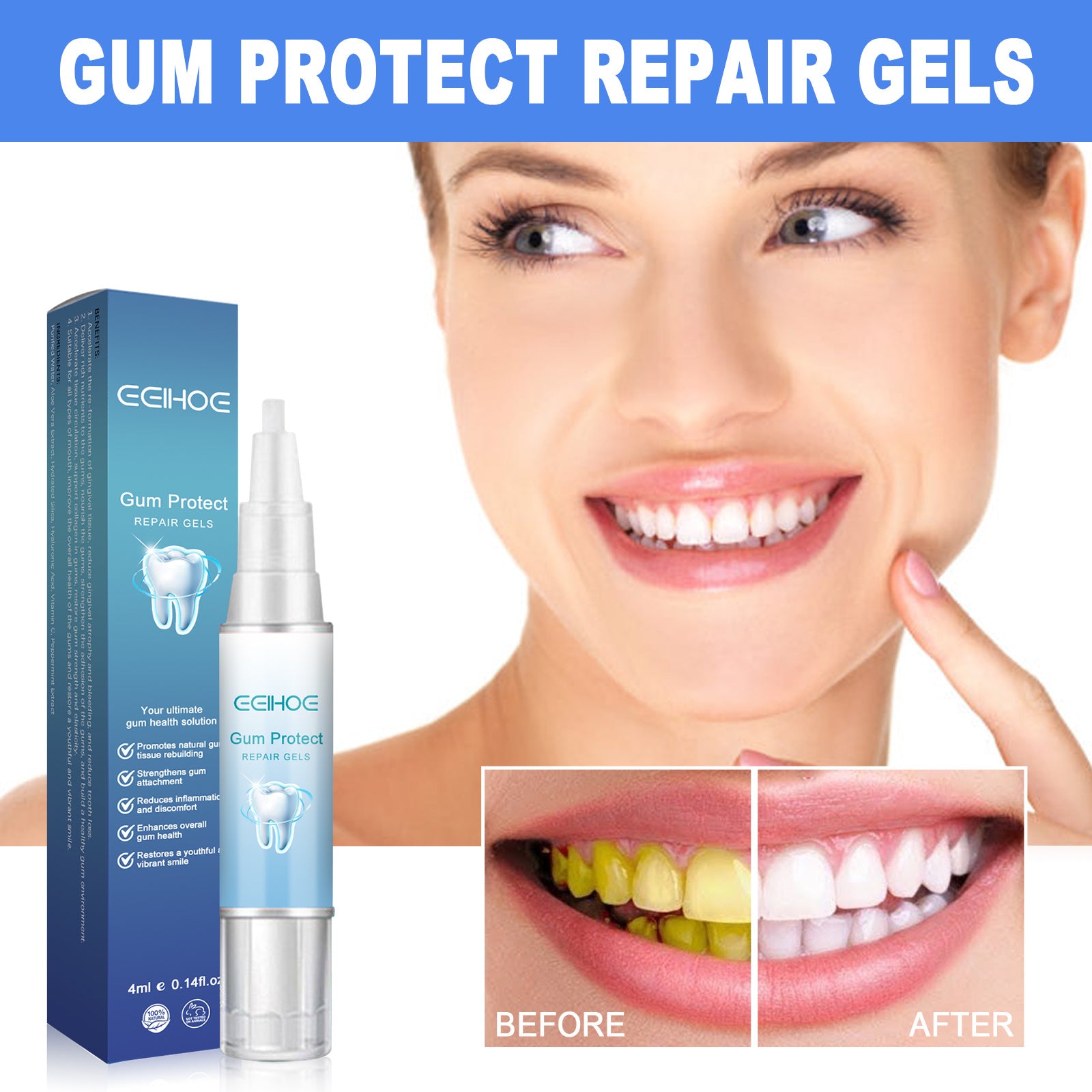 Eelhoe Dental Repair Gel, Repair Gums Cleaning Dental Stains | Other