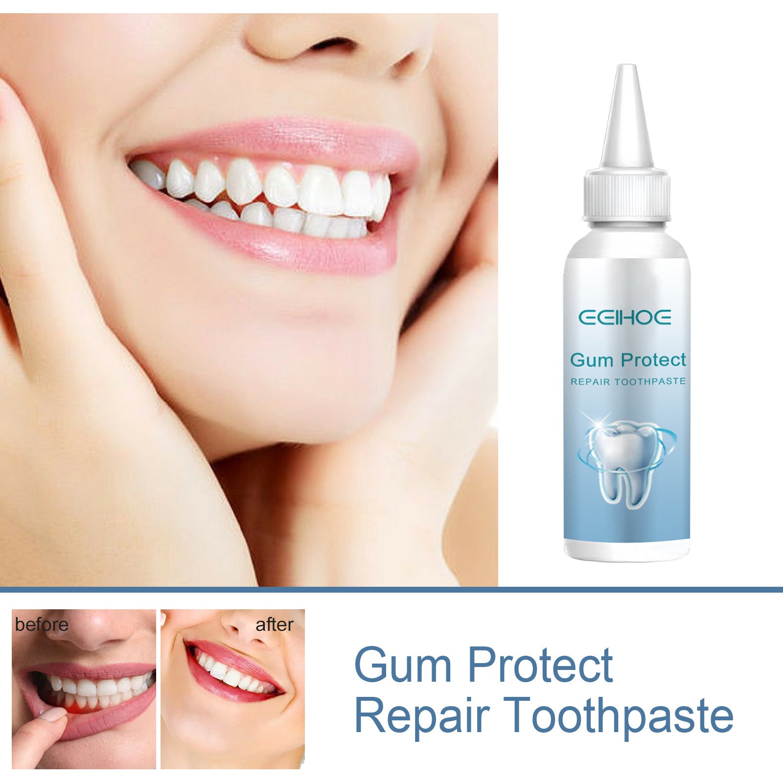 Eelhoe Gum Repair Series Cleaning | Other
